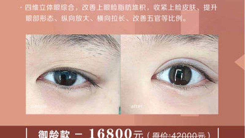 涂抹式玻尿酸：日常保养的得力助手