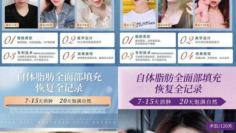 广州激光美容医院祛斑和美白区别