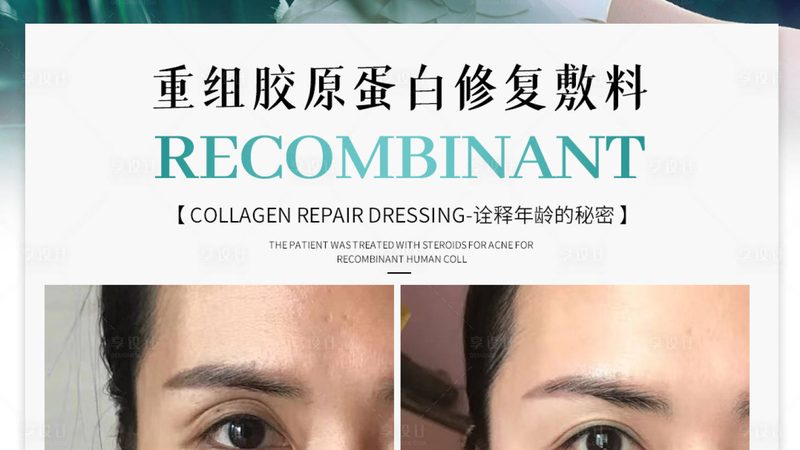 成都全身激光脱毛，价格之外你还应该知道这些**