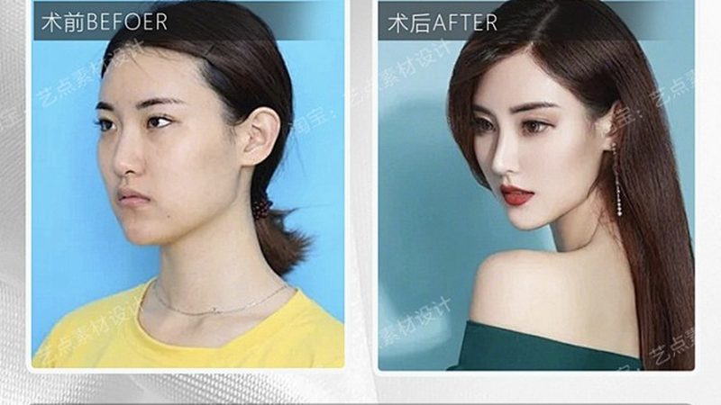 水光针与微针，效果维持时间差在哪