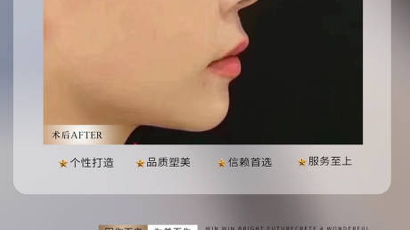 轻医美和整形哪个更安全