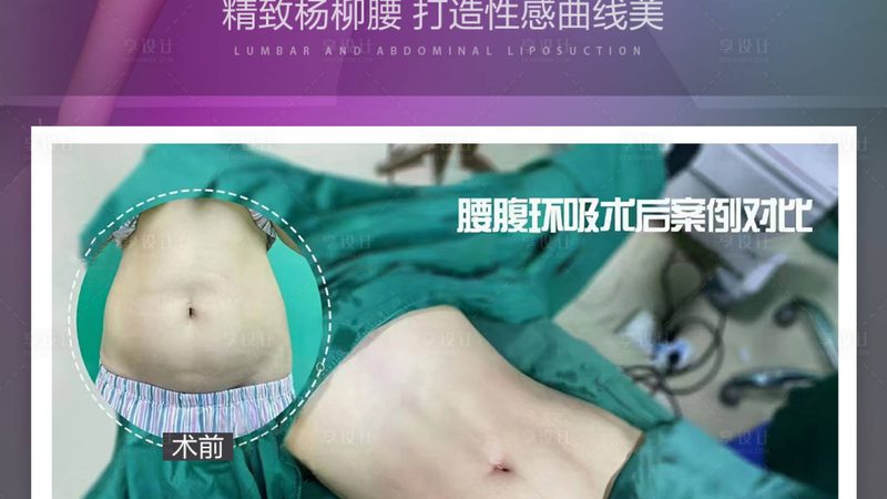 玻尿酸批发价探底，背后藏着哪些行业真相