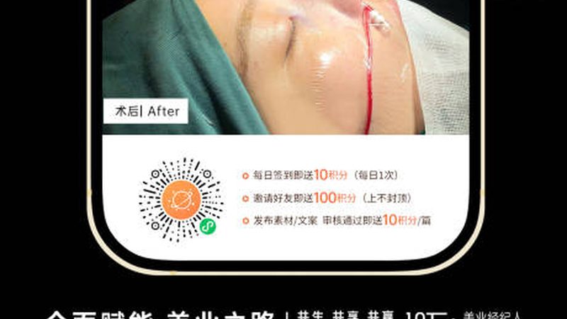 敏感肌激光脱毛会伤皮肤吗