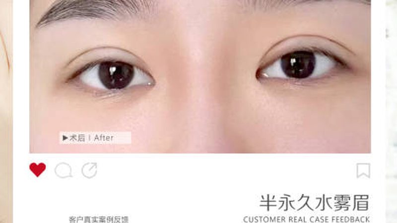 轻医美项目年龄限制注意事项
