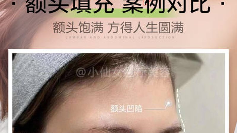 整形美容合同退款条款的五大关键要素