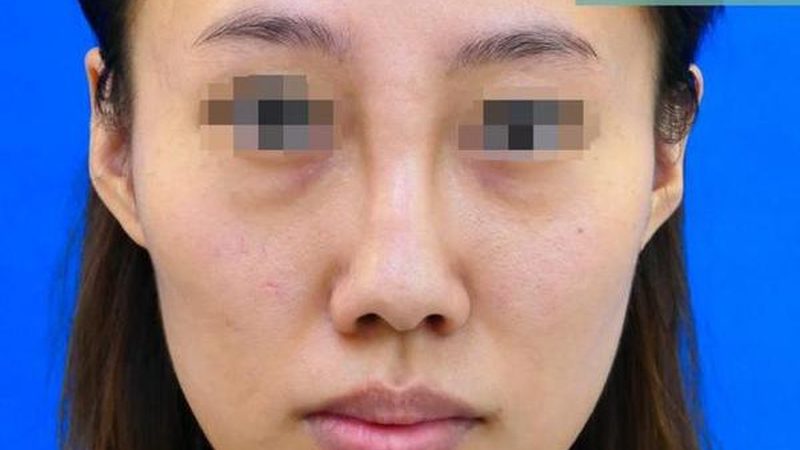 激光美容嫩肤，如何选择靠谱医院？**